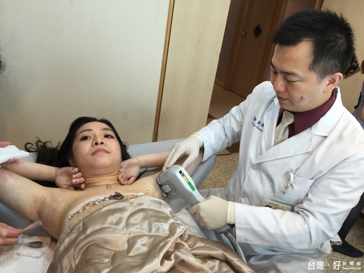 張譯允主任表示,「腋淨爽」微波熱能治療是一種無痛非侵入性療法,一至兩次的療程後,腋下的出汗量平均可減少八成。