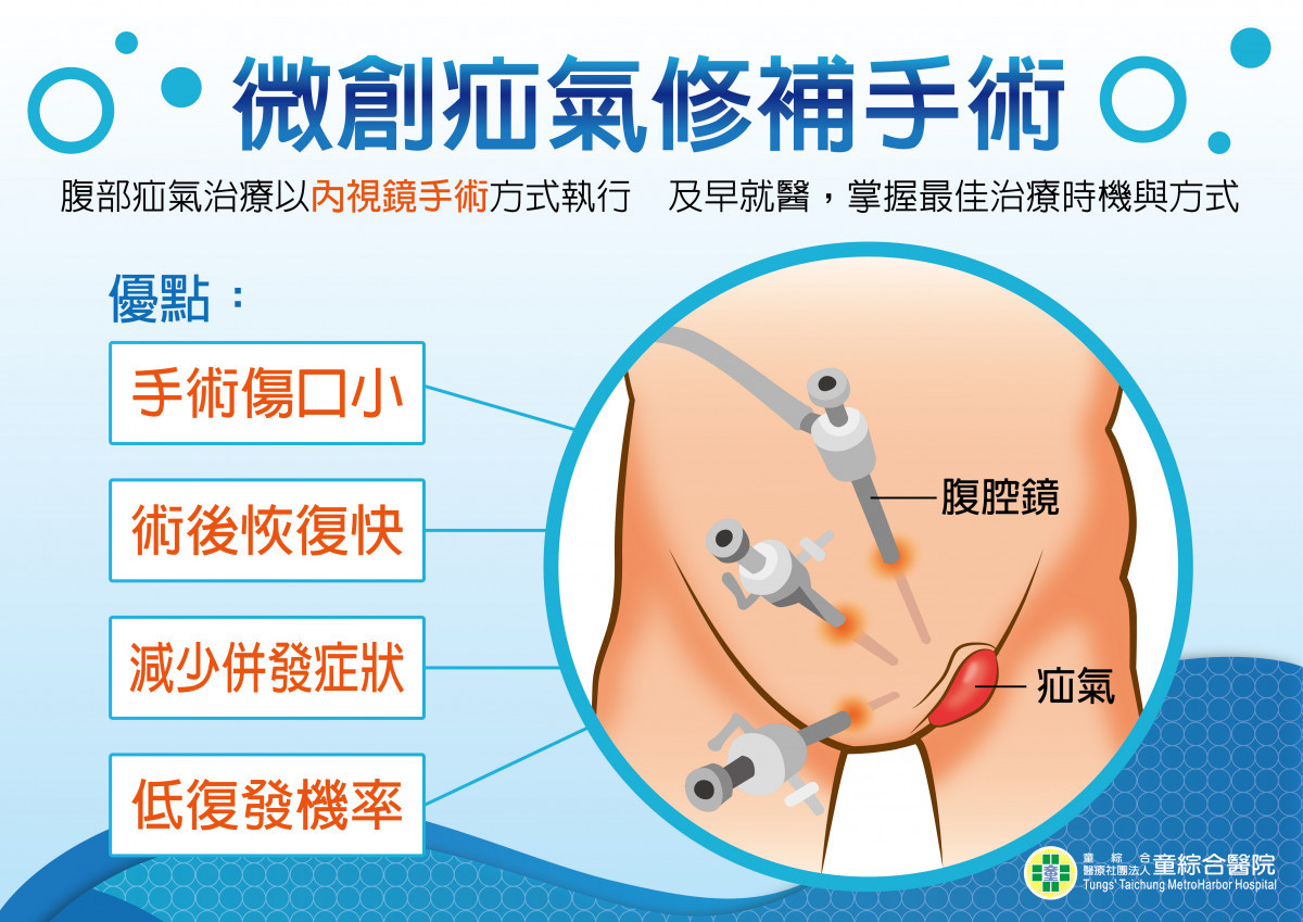 微創腹膜外內視鏡疝氣修補手術。