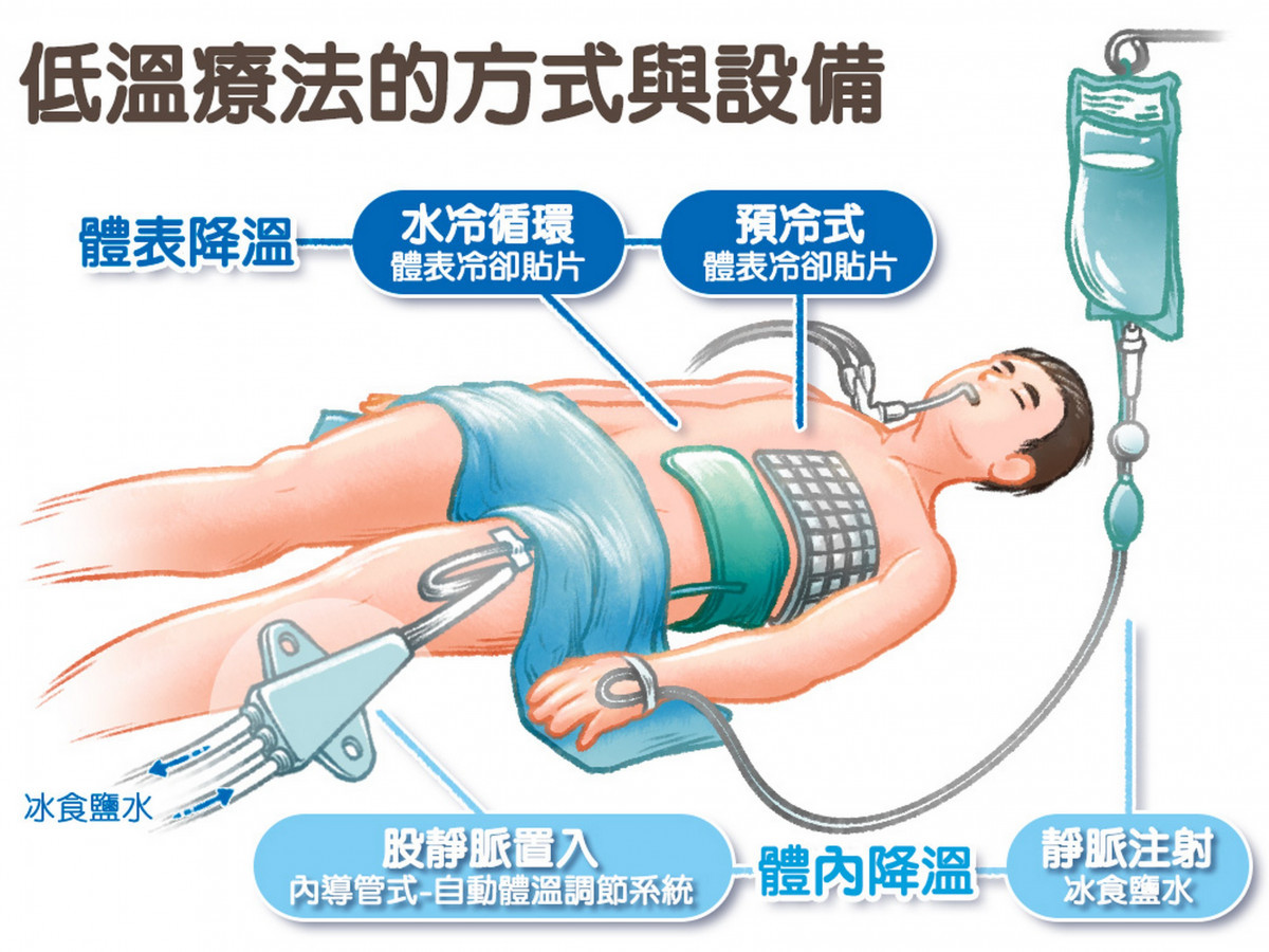 低溫療法方式與設備。