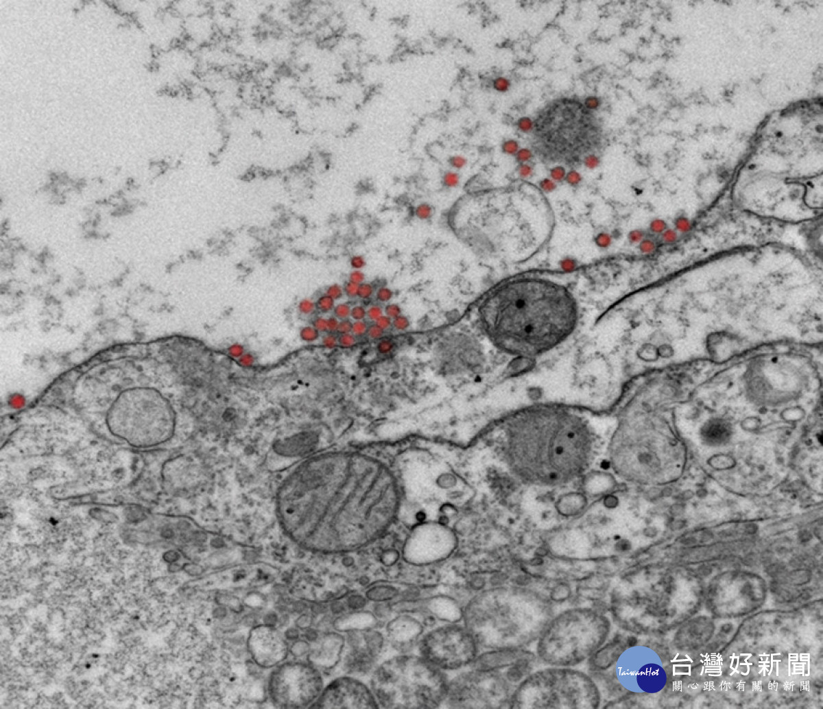 圖為電子顯微鏡下細胞受到新冠病毒(紅色)攻擊
