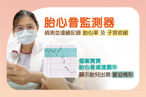 胎心音減速說明。