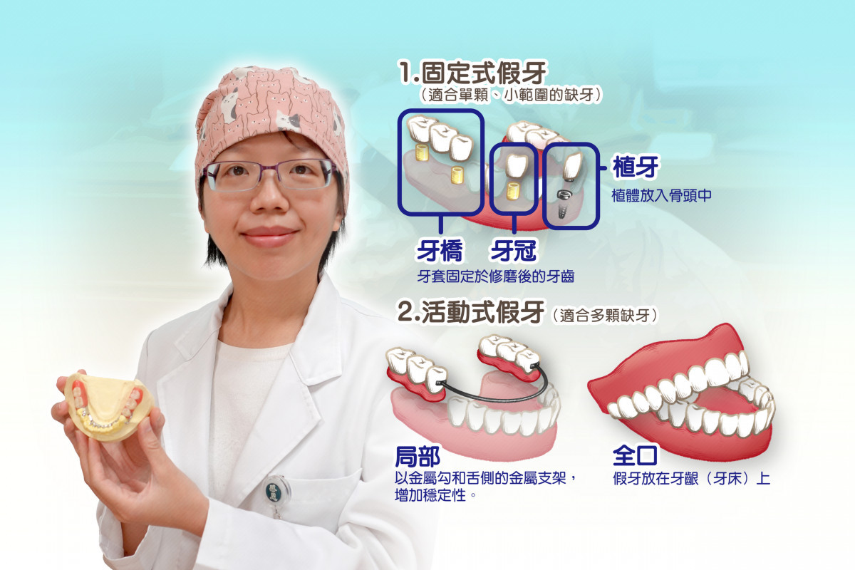 植牙並非人人合適　牙科醫師建議須考量個人體質-指尖日報