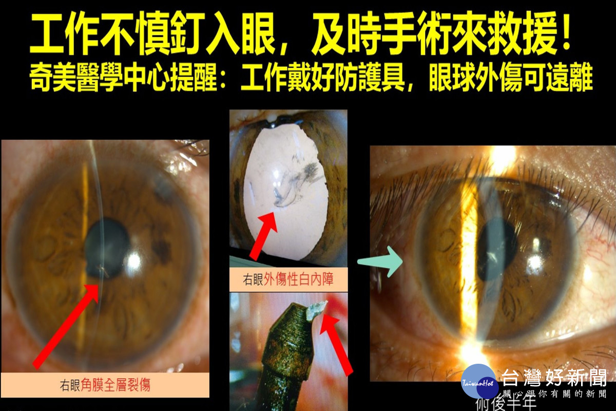 高清拍摄人的眼球透明恐怖迎面飞来许多鸟儿