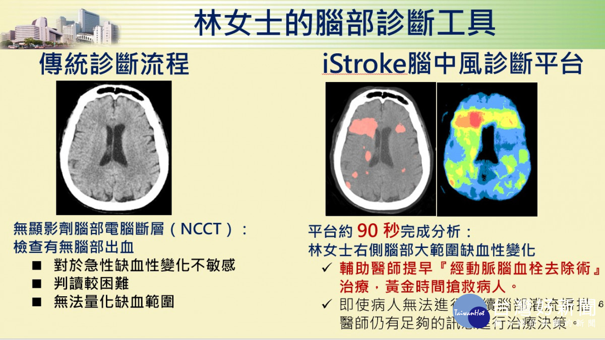 中國附醫人工智慧中心90秒內就診斷出昏迷的林女士右側腦血管嚴重阻塞缺血。中國附醫提供