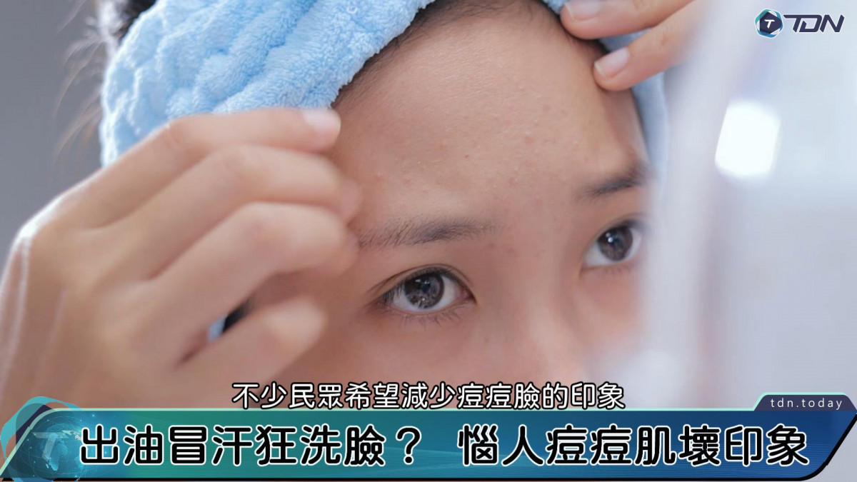 影／狂洗臉控油抗青春痘！　皮膚科醫：正確保油濕潤才能清痘