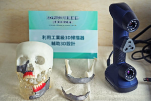 ▲工研院與高雄榮民總醫院創新研發的3D列印口顎彌補物，以高生物相容性的鈦合金為材料，具備關鍵專利技術及客製化設計，已完成九例臨床試驗，所有植入物皆無鬆脫，超過半數患者能開始咀嚼食物，確保營養攝取且保留對稱性外觀。