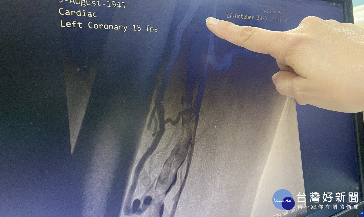 八十歲老翁車禍左腿傷口無法痊癋　就醫才發現右腳靜脈幾乎全栓塞恐裁肢