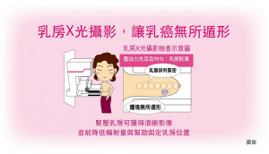 乳房X光攝影檢查示意圖（圖／資料照片，圖源：翻攝自衛福部國民健康署健康九九網站建置的「健康九九影音資訊平台」YouTube）