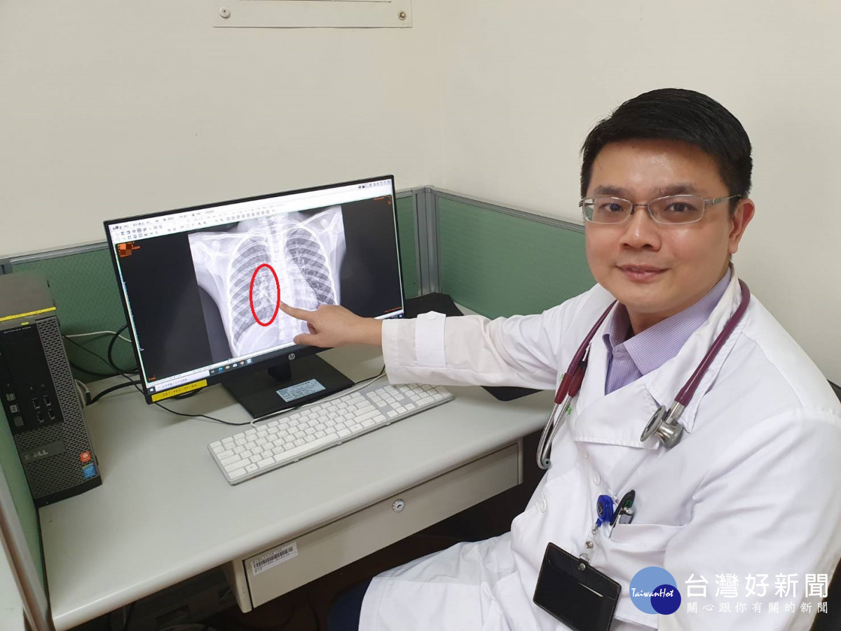 人類間質肺炎病毒搞怪　醫：分子診斷工具精準快速判斷