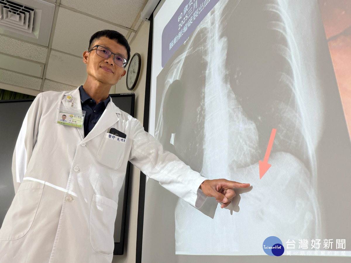 吳明駿醫師說明鼻胃管在患者胃內揪結彎曲的位置。