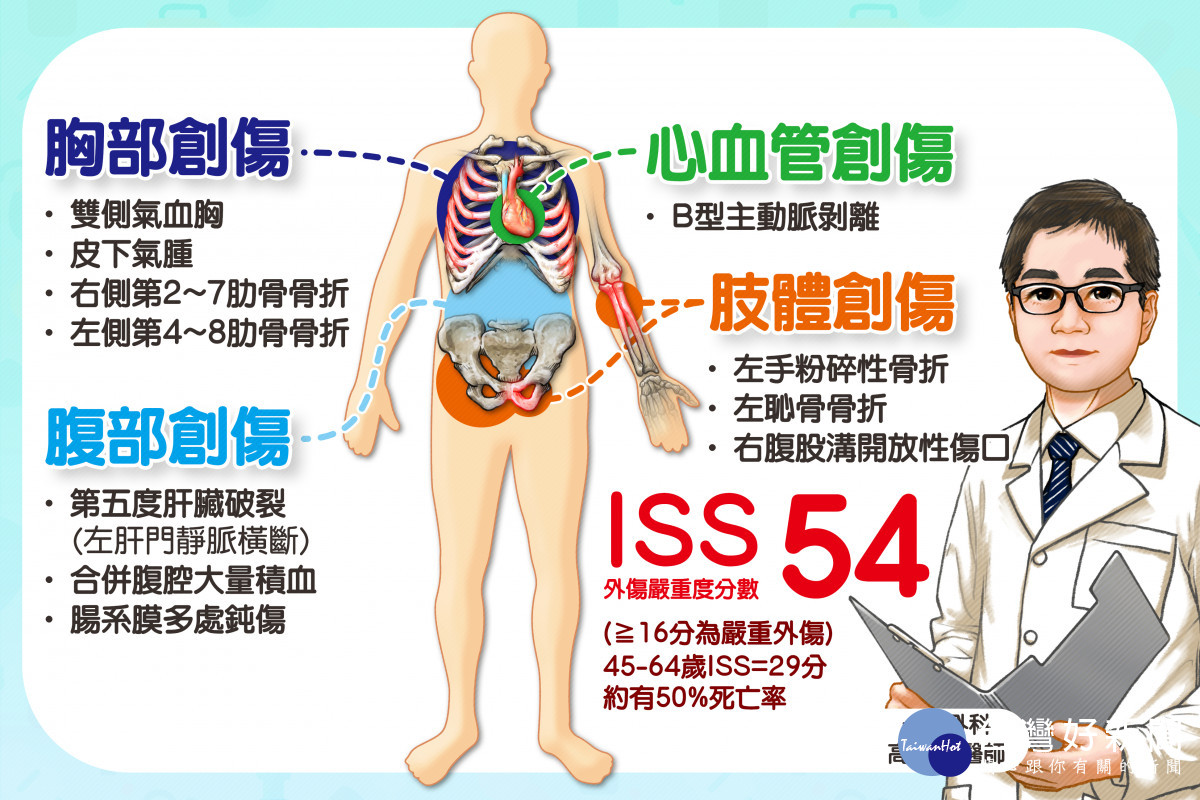 胡先生多處創傷，外傷嚴重度評分（ISS）高達54分，屬極重度外傷，預估死亡率極高。