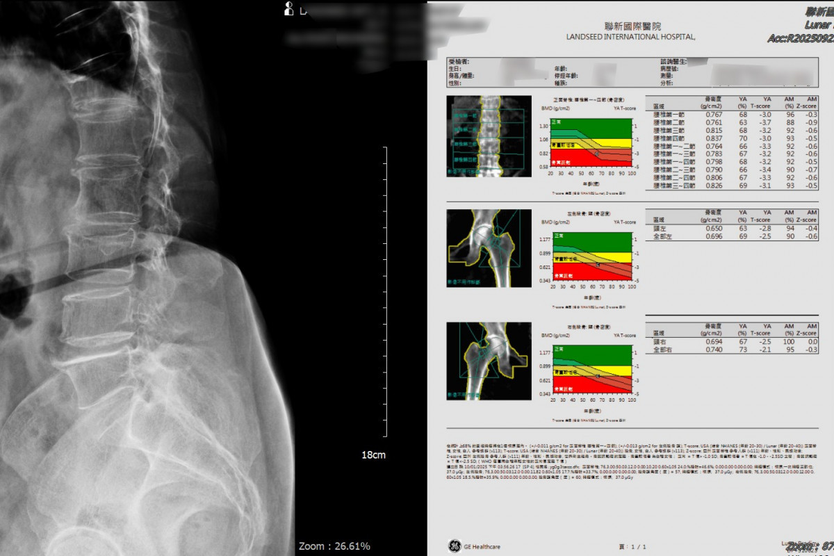 密度與X光片檢查示意圖