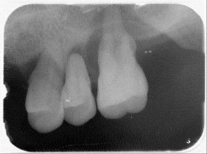 （圖／北榮桃園分院提供）