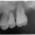 （圖／北榮桃園分院提供）