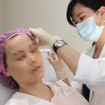 水光治療。林重鎣