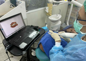 王惠禎醫師示範止鼾牙套（MAD）透過前移下顎，藉由頦舌肌牽引擴大咽喉兩側空間並提升周邊肌群張力，以改善上呼吸道塌陷。