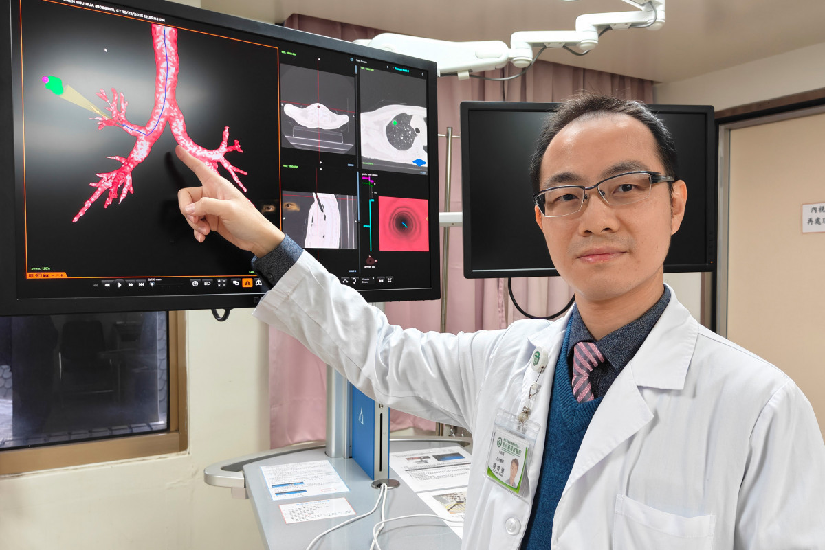 肺癌診斷與手術同日完成　彰基「一站式」微創治療精準守護肺健康