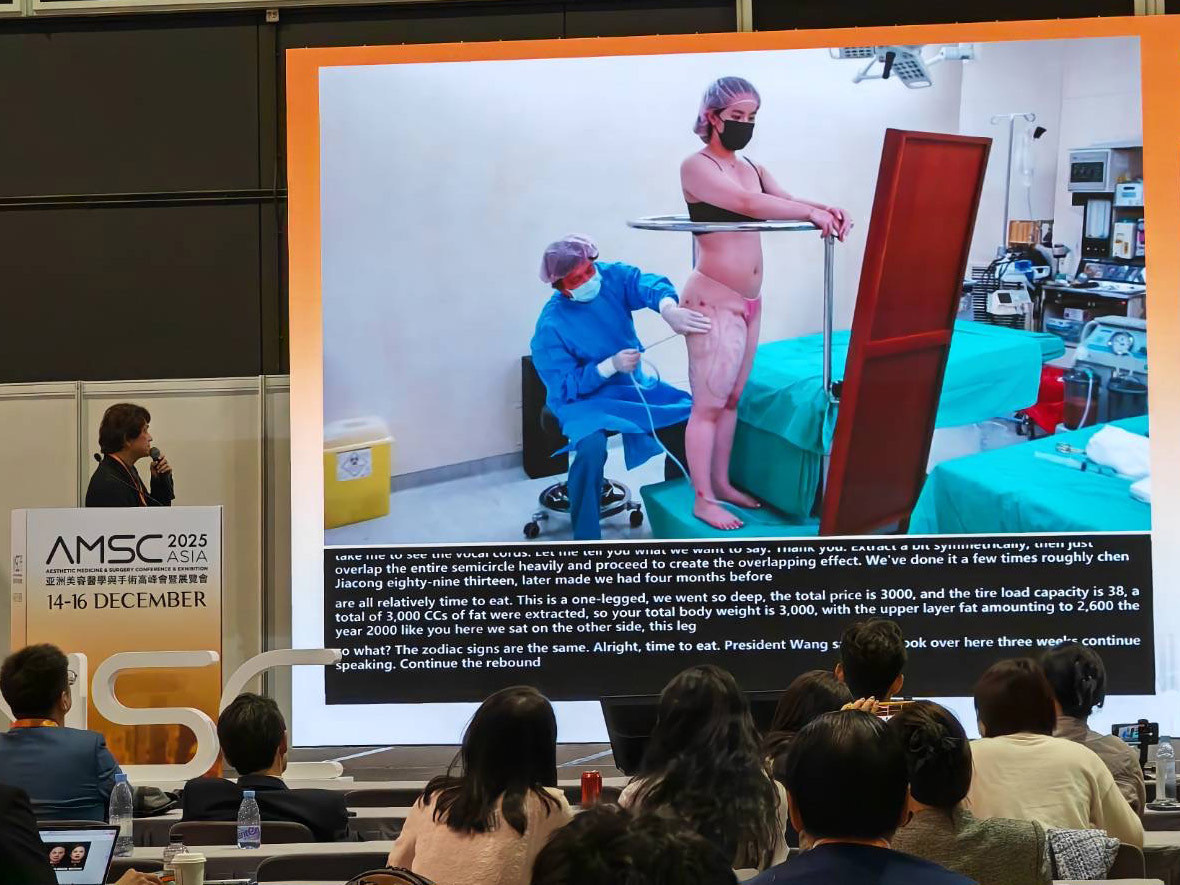 腹部抽脂安全引發熱議　醫學專家分析麻醉方式與併發症預防關鍵