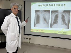 衛生福利部臺中醫院腫瘤內科江佳駿醫師說明，患者到院時左胸有14公分惡性腫瘤（左圖），經過初步標靶合併化療，腫瘤大為縮小，有明顯改善（右圖）。圖/台中醫院提供