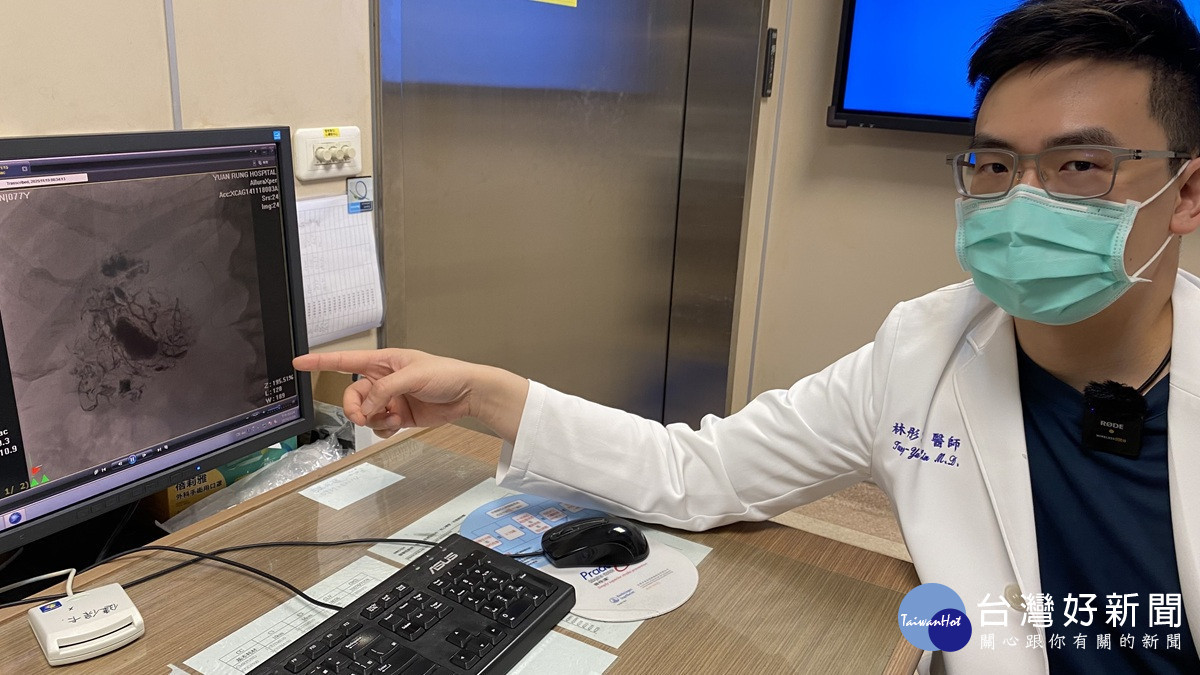 巨型肝癌不用開大刀   醫師「氣球封鎖術」78 歲阿公術後能跑能跳