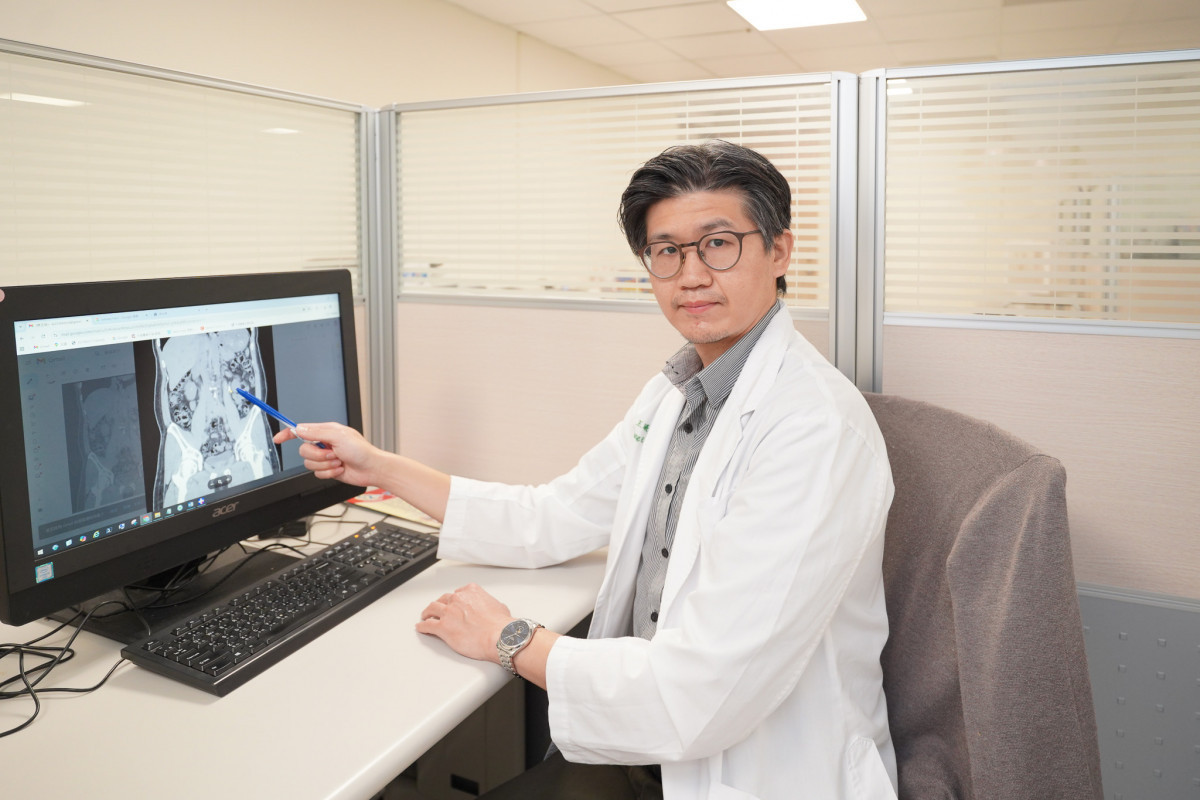 雙側輸尿管結石潛伏風險高　取石手術解除危機