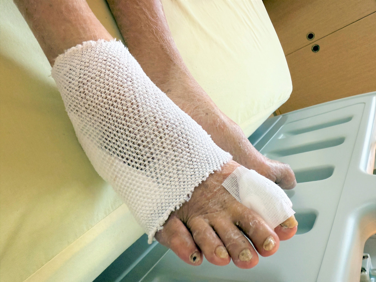 部桃守護下肢健康　周邊動脈阻塞早防治