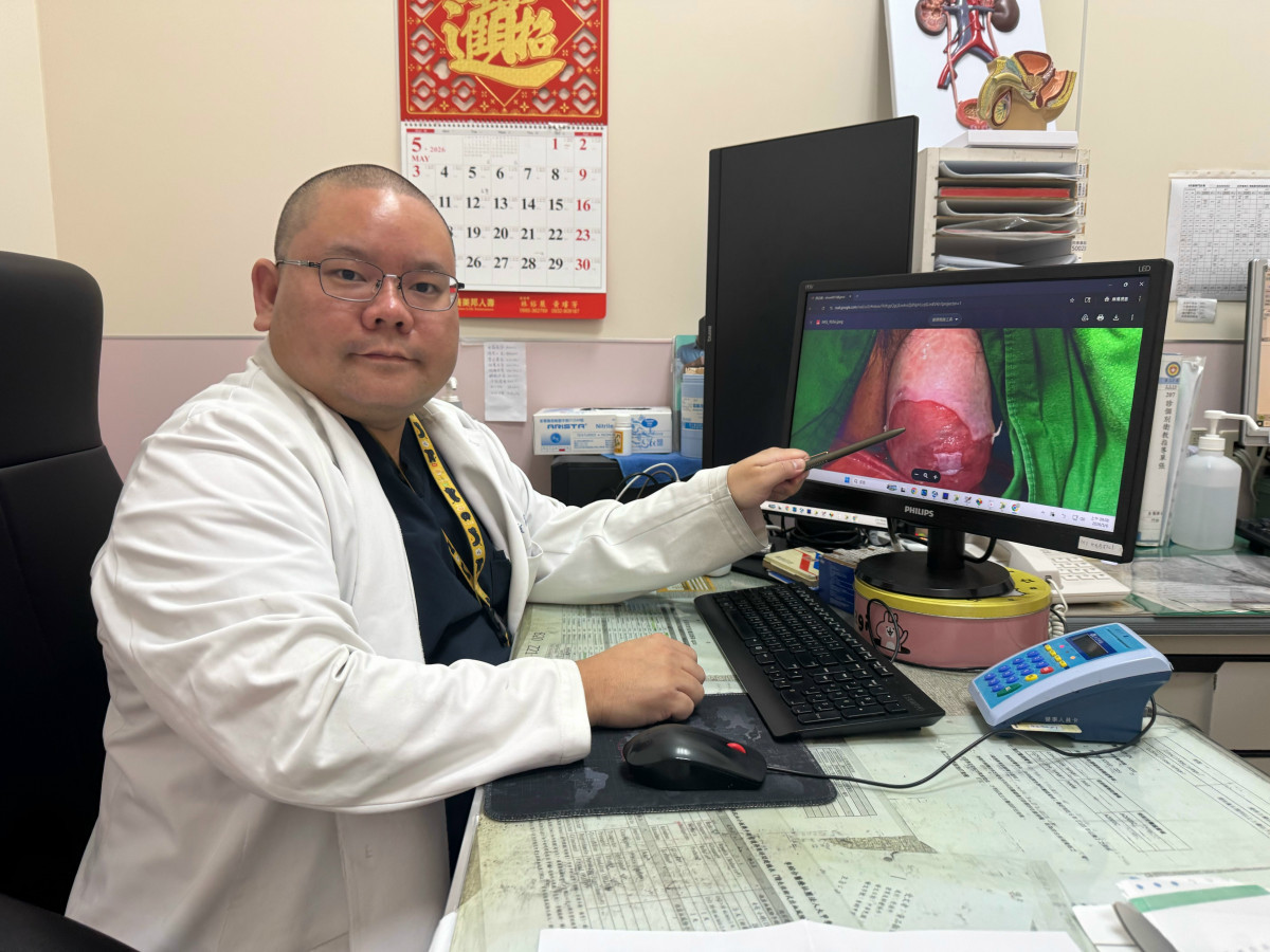 婦尿不乾淨狂發燒　竟是子宮脫垂拉出膀胱