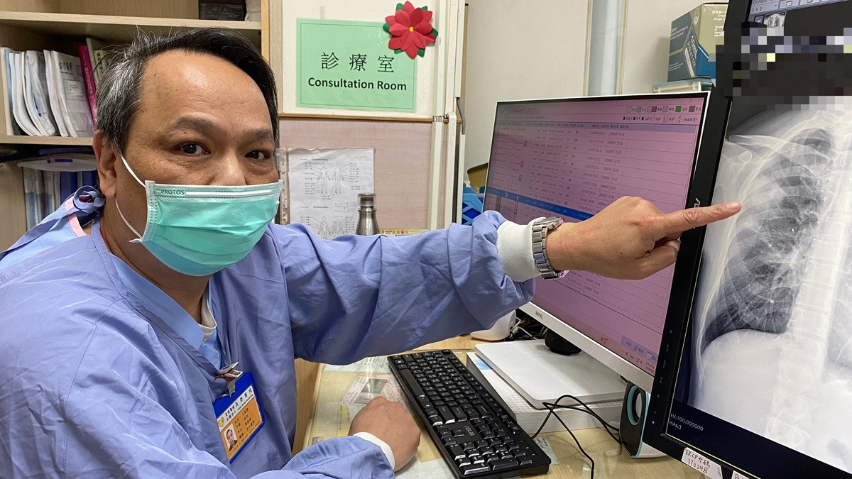壯男赴日返台咳不停　員榮醫靠電腦斷層揪出「肺膿瘍」