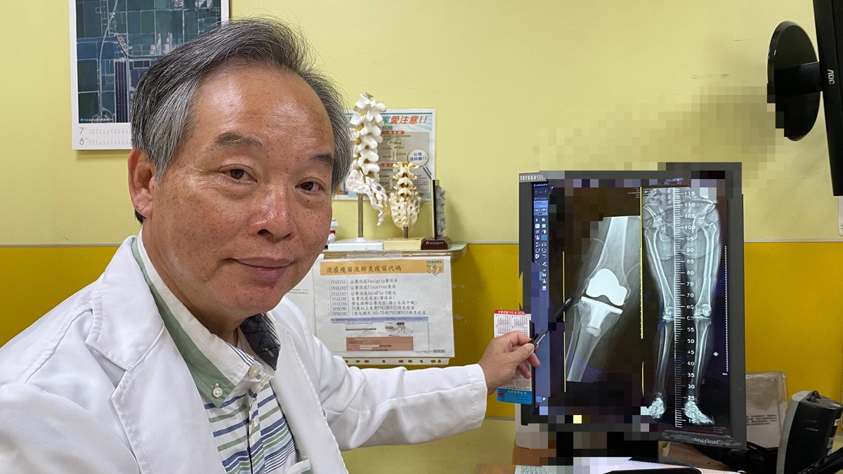 原要換膝關節竟變「緊急開腦」 跨科團隊及時攔截隱形殺手救回婦人