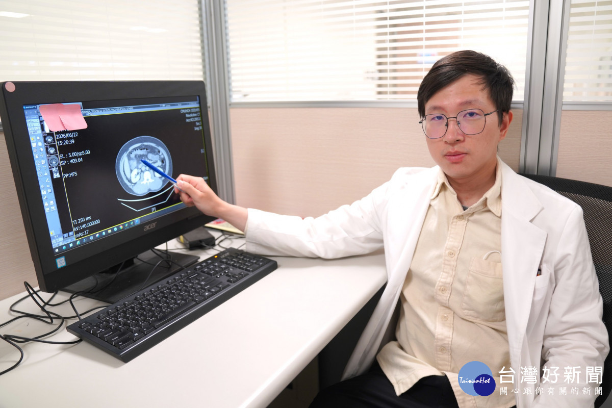 右腹痛急就醫　竟是升結腸憩室炎作祟