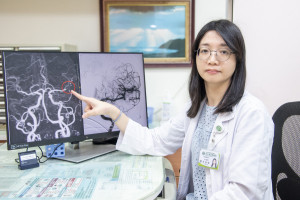李媐雁醫師表示，游女士突發右側無力、口齒不清，確診左側大腦中動脈阻塞，團隊緊急施打血栓溶解劑並進行動脈取栓治療。圖／彰基提供