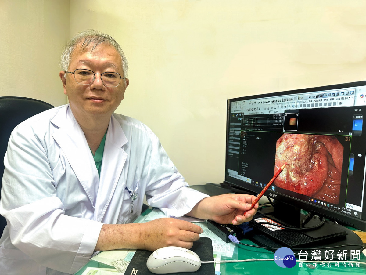 胃癌也可能沒有前兆　68歲男有症狀就醫已第三期