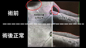 術前術後對比圖。