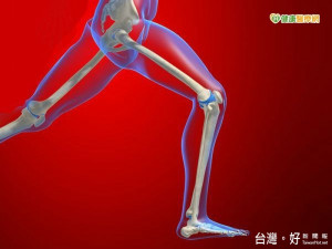 股骨頭壞死中醫療法　及早診治可免換人工關節