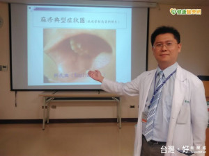 9個月大男嬰出國染麻疹　引發肺炎及結膜炎