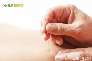這裡疼那裡痛　針灸止痛效果佳