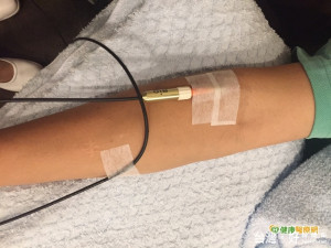 低能量靜脈雷射光療　可控血糖降血脂