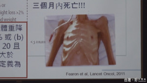 四成癌患死於營養不良　應避免惡病質上身