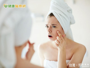 少年長青春痘　成年皮膚較能凍齡？