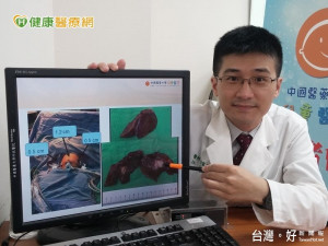 台灣兒童外科創新頁　8月嬰完成腹腔鏡腫瘤切除
