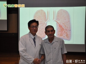 中年男40年來反覆咳血　肺手術後終擺脫病症