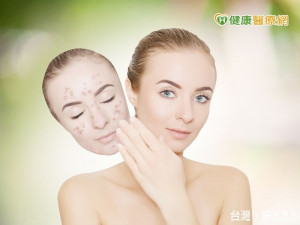 春節熬夜玩樂　小心青春痘來攪局