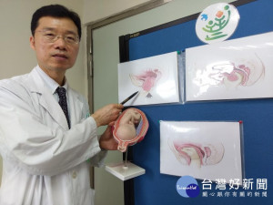 少婦產後疼痛大出血，竟是子宮外翻作怪。