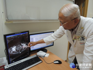 3年沒做子宮頸抹片檢查　老阿嬤小便出血已是癌末期
