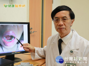 發覺藥物過敏！　遵從醫囑救了自己一命