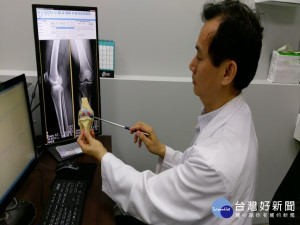 闗節磨損嚴重要換人工闗節。林重鎣攝