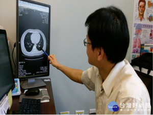 沒抽煙也肺結核。林重鎣攝