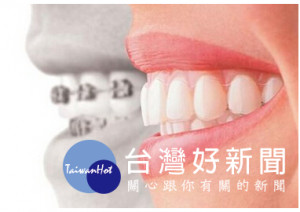 圖說：新型牙齒矯正技術比起傳統大鋼牙不只隱形美觀，更方便清潔與進食
