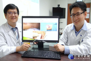 一般泌尿科主任廖建華及泌尿外科主治醫師蘇家震兩人說，微創超精細腎臟鏡取石手術傷口僅0.5公分如左邊吸管口大小.適合腎結石約2.5公分.體外碎石失敗的案例或結石太硬不易排出。