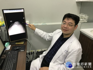 醫師指著車禍受傷膝蓋。林重鎣攝